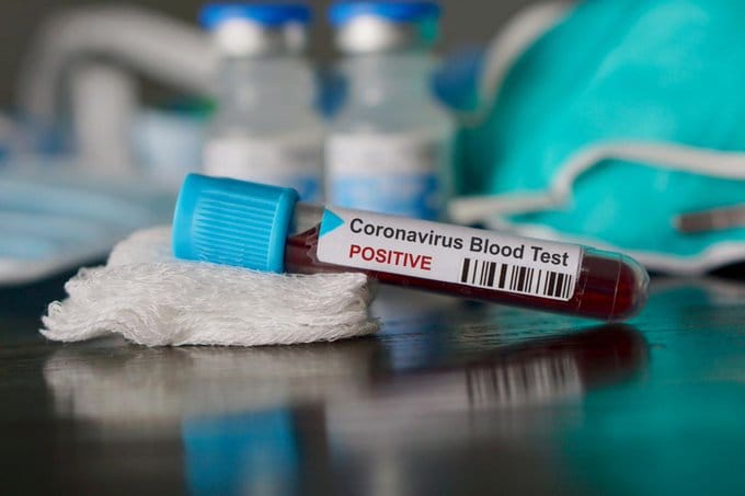 koronavirus